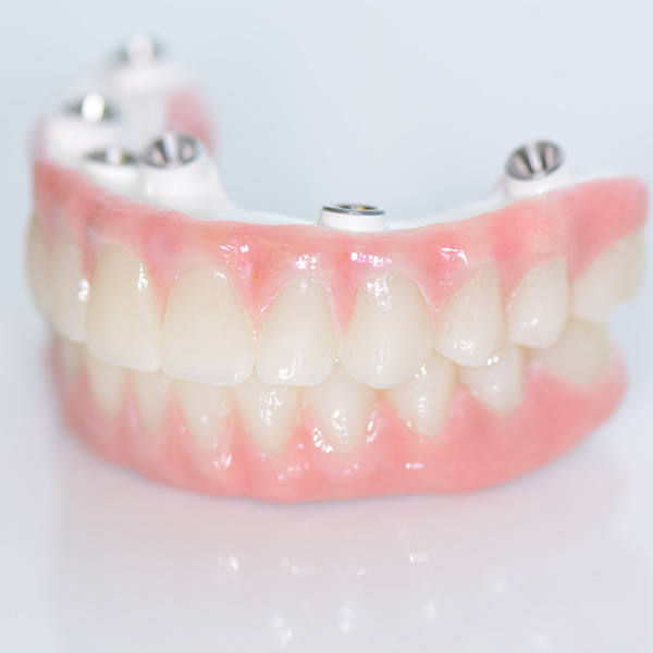Final Teeth Delivered